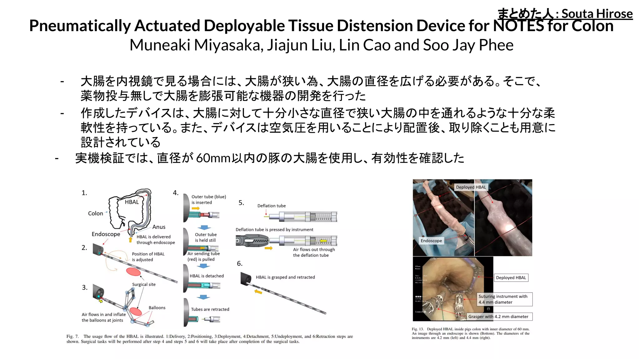 Pneumatically Actuated Deployable Tissue Distension Device for NOTES for Colon
Muneaki Miyasaka, Jiajun Liu, Lin Cao and Soo Jay Phee
- 作成したデバイスは、大腸に対して十分小さな直径で狭い大腸の中を通れるような十分な柔
軟性を持っている。また、デバイスは空気圧を用いることにより配置後、取り除くことも用意に
設計されている
- 大腸を内視鏡で見る場合には、大腸が狭い為、大腸の直径を広げる必要がある。そこで、
薬物投与無しで大腸を膨張可能な機器の開発を行った
- 実機検証では、直径が 60mm以内の豚の大腸を使用し、有効性を確認した
まとめた人：Souta Hirose
 