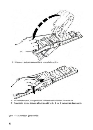30
•ekil ‹ 41 Spanzetin gerdirilmesi.
 