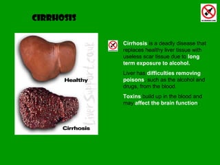 Cirrhosis is a deadly disease that
replaces healthy liver tissue with
useless scar tissue due to long
term exposure to alcohol.
Liver has difficulties removing
poisons, such as the alcohol and
drugs, from the blood.
Toxins build up in the blood and
may affect the brain function.
cirrhosis
 