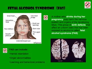 Fetal alcohol syndrome (fas)
A mother who drinks during her
pregnancy may harm the nervous
system and organs of the developing
fetus. This group of birth defects that
affect an unborn baby that has been
exposed to alcohol is called fetal
alcohol syndrome (FAS)
FAS can include:
•mental retardation
•Organ abnormalities
•Learning and behavioral problems
 