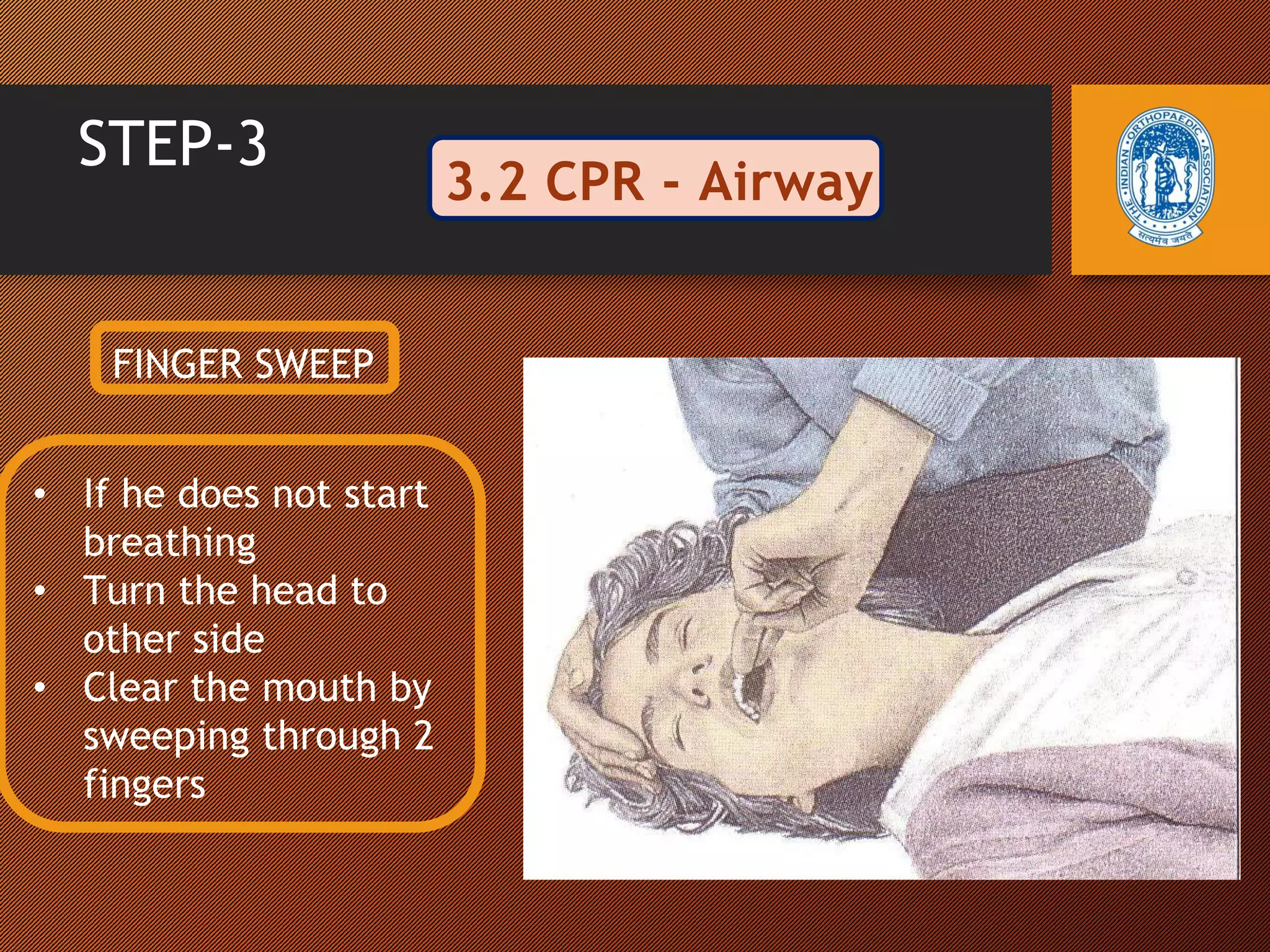 Road safety and first aid after trauma | PPTX