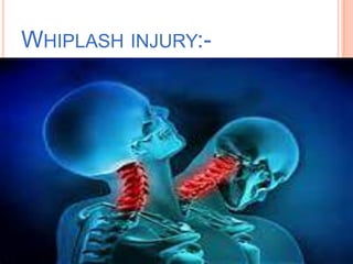 WHIPLASH INJURY:-

 
