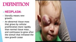 NEOPLASM:
 literally means new
growth.
 An abnormal tissue mass
that grows by cellular
proliferation more rapidly
than normal tissue mass ,
and continuous to grow after
the stimuli that initiated the
new growth cease
DEFINITION
 