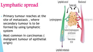 Lymphatic spread
 Primary tumour reaches at the
site of metastasis , where
secondary tumour is to be
formed by using lymphatic
system
 Most common in carcinomas (
malignant tumour of epithelial
origin)
 