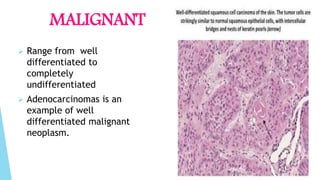 MALIGNANT
 Range from well
differentiated to
completely
undifferentiated
 Adenocarcinomas is an
example of well
differentiated malignant
neoplasm.
 