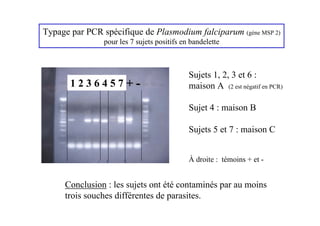 Typage par PCR spécifique de Plasmodium falciparum (gène MSP 2)
                pour les 7 sujets positifs en bandelette



                                             Sujets 1, 2, 3 et 6 :
       1236457+-                             maison A (2 est négatif en PCR)

                                             Sujet 4 : maison B

                                             Sujets 5 et 7 : maison C


                                             À droite : témoins + et -


     Conclusion : les sujets ont été contaminés par au moins
     trois souches différentes de parasites.
 