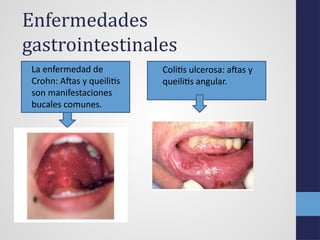 Manifestacionesbucales de enfermedadessistemicas... | PPTX