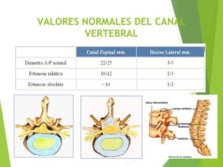 VALORES NORMALES DEL CANAL
VERTEBRAL
 