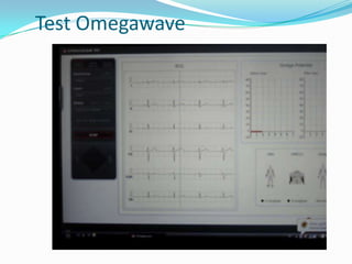 Test Omegawave