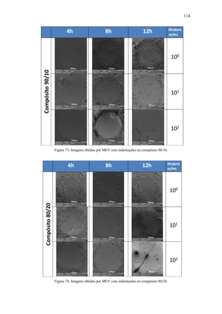 114
4h 8h 12h #indent
ações
Compósito
90/10
100
101
102
200μm
200μm
200μm
200μm
200μm
200μm
200μm
200μm 200μm
Figura 73: Imagens obtidas por MEV com indentações no compósito 90/10.
4h 8h 12h #indent
ações
Compósito
80/20
100
101
102
200μm
500μm 500μm
200μm
200μm
200μm
200μm
200μm
200μm
Figura 74: Imagens obtidas por MEV com indentações no compósito 80/20.
 