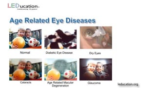 Normal Diabetic Eye Disease Dry Eyes
Cataracts Age Related Macular
Degeneration
Glaucoma
 