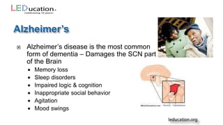  Alzheimer’s disease is the most common
form of dementia – Damages the SCN part
of the Brain
 Memory loss
 Sleep disorders
 Impaired logic & cognition
 Inappropriate social behavior
 Agitation
 Mood swings
 