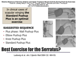 Best Exercise for the Serratus?
Ludewig et al. Am J Sports Med 2004 32: 484-93.
SUGGESTED SEQUENCE
• Plus phase: Wall Pushup Plus
• Elbow Pushup Plus
• Knee Pushup Plus
• Standard Pushup Plus
In clinical cases of
scapular winging the
Standard Pushup
Plus is an optimal
exercise
 