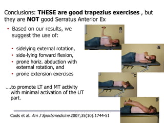 Conclusions: THESE are good trapezius exercises , but
they are NOT good Serratus Anterior Ex
• sidelying external rotation,
• side-lying forward flexion,
• prone horiz. abduction with
external rotation, and
• prone extension exercises
….to promote LT and MT activity
with minimal activation of the UT
part.
• Based on our results, we
suggest the use of:
Cools et al. Am J Sportsmedicine.2007;35(10):1744-51
 
