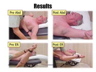 Results
Post ER
Post AbdPre Abd
Pre ER
 