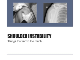 SHOULDER INSTABILITY
Things that move too much…
 