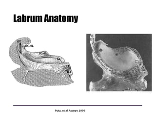 Labrum Anatomy
Putz, et al Ascopy 1999
 