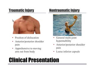 Clinical Presentation
Traumatic Injury
• Position of dislocation
• Anterior/posterior shoulder
pain
• Apprehensive to moving
arm out from body
Nontraumatic Injury
• General multi-joint
hypermobility
• Anterior/posterior shoulder
pain
• Loose inferior capsule
 