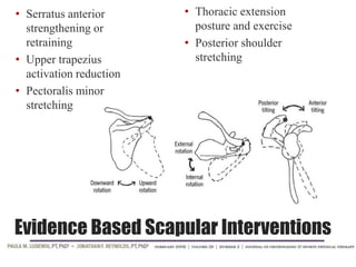 Evidence Based Scapular Interventions
• Serratus anterior
strengthening or
retraining
• Upper trapezius
activation reduction
• Pectoralis minor
stretching
• Thoracic extension
posture and exercise
• Posterior shoulder
stretching
 