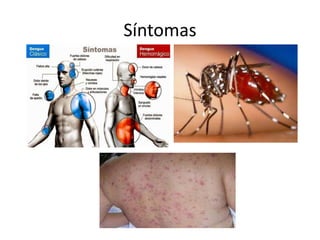 Síntomas 
 