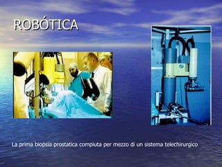 ROBÓTICA La prima biopsia prostatica compiuta per mezzo di un sistema telechirurgico  