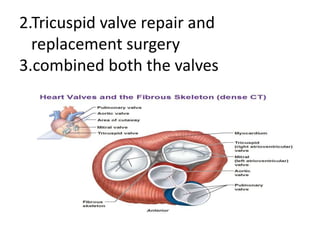 2.Tricuspid valve repair and
replacement surgery
3.combined both the valves
 