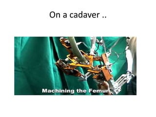 On a cadaver ..
 