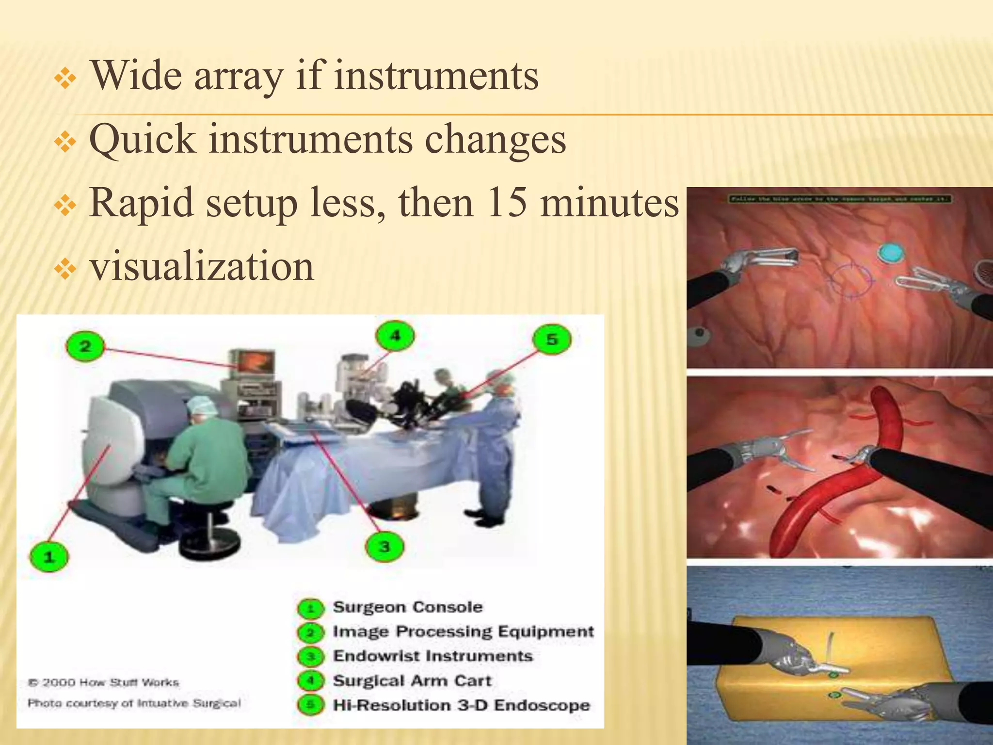  Wide array if instruments
 Quick instruments changes
 Rapid setup less, then 15 minutes
 visualization
 