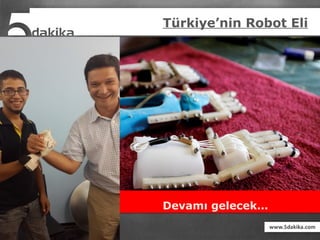 Türkiye’nin Robot Eli
Devamı gelecek…
 