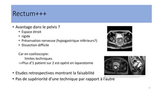 Rectum+++
• Avantage dans le pelvis ?
• Espace étroit
• rigide
• Préservation nerveuse (hypogastrique inférieurs?)
• Dissection difficile
Car en coelioscopie:
limites techniques
ÞPlus d’1 patient sur 2 est opéré en laparotomie
• Etudes retrospectives montrant la faisabilité
• Pas de supériorité d’une technique par rapport à l’autre
12
 