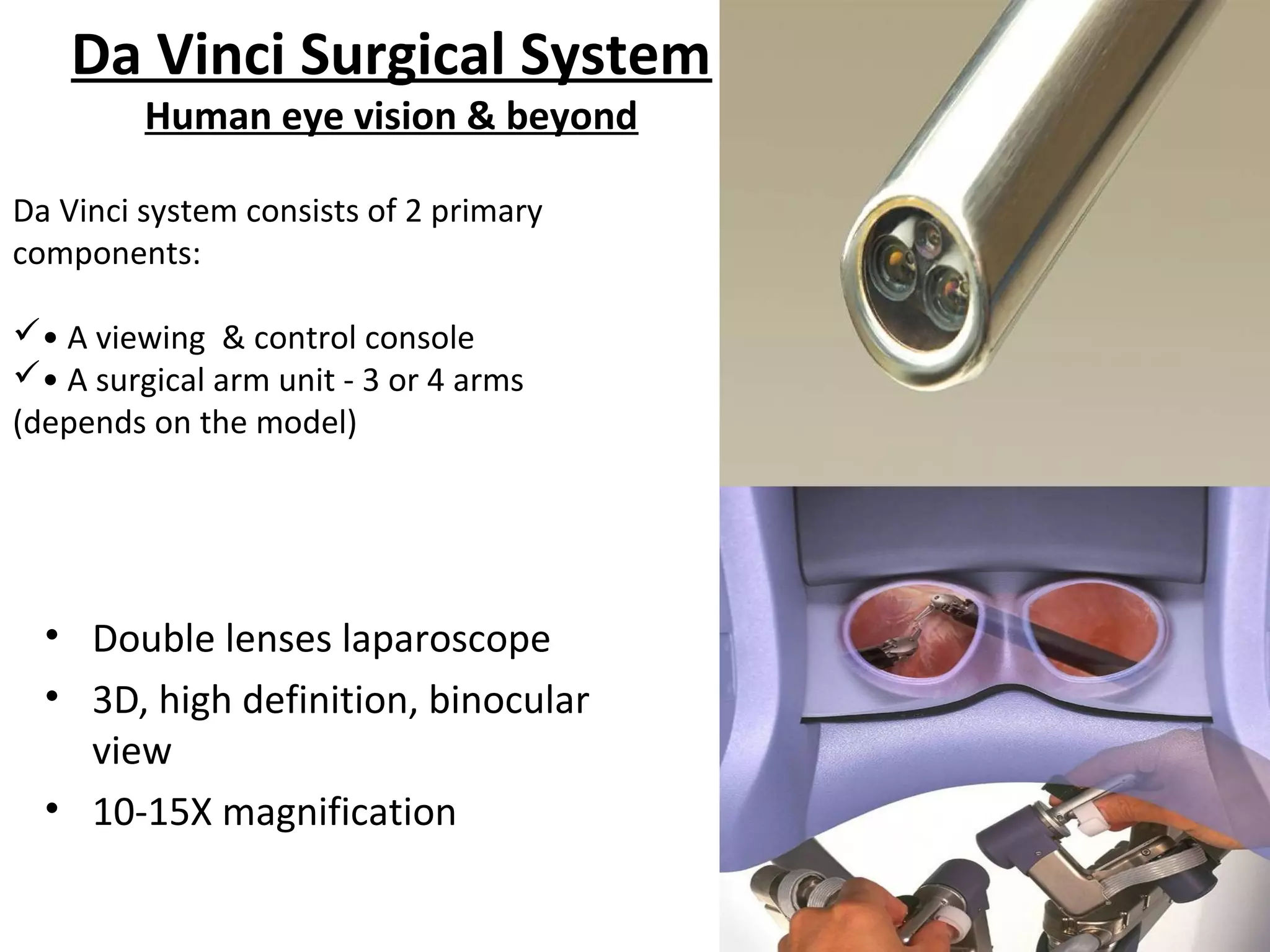 Da Vinci Surgical System
Human eye vision & beyond
• Double lenses laparoscope
• 3D, high definition, binocular
view
• 10-15X magnification
Da Vinci system consists of 2 primary
components:
• A viewing & control console
• A surgical arm unit - 3 or 4 arms
(depends on the model)
 
