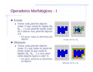 Operadores Morfológicos - I
Erosão
Tomar cada pixel de objecto
(valor 1) que esteja N—ligado (N4,
N8, ...) a um pixel de fundo (valor
0) e colocar esse pixel do objecto
a 0.
Em geral, reduz as dimensões do
objecto
Dilatação
Tomar cada pixel de objecto
(valor 1) e pôr todos os pixels de
fundo (valor 0) que estão N-
ligados (N4, N8, ...) a esse pixel
como objecto (para o valor 1).
Em geral, aumenta as dimensões
do objecto
Erosão com N4 e N8
Dilatação com N4 e N8
 