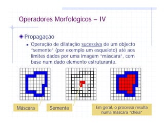 Operadores Morfológicos – IV
Propagação
Operação de dilatação sucessiva de um objecto
“semente” (por exemplo um esqueleto) até aos
limites dados por uma imagem “máscara”, com
base num dado elemento estruturante.
Máscara Semente Em geral, o processo resulta
numa máscara “cheia”
 