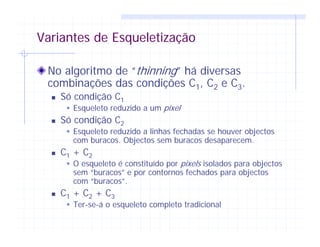 Variantes de Esqueletização
No algoritmo de “thinning” há diversas
combinações das condições C1, C2 e C3.
Só condição C1
Esqueleto reduzido a um pixel
Só condição C2
Esqueleto reduzido a linhas fechadas se houver objectos
com buracos. Objectos sem buracos desaparecem.
C1 + C2
O esqueleto é constituído por pixels isolados para objectos
sem “buracos” e por contornos fechados para objectos
com “buracos”.
C1 + C2 + C3
Ter-se-á o esqueleto completo tradicional
 