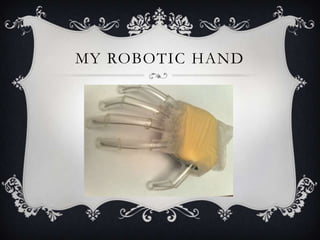 My robotic hand