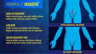 Open surgicalincision
daVinci® incisions
minimallyinvasive
smaller incisions
Robotic-assisted surgery uses much smaller incisions,
making it safer than open surgical methods
less risk
Smaller incisions can minimize risk of infection,
helping the body heal with less risk of complication
faster recoverytime
Enhances patient recovery and outcome, allowing
patients to get back to their normal routine faster
 