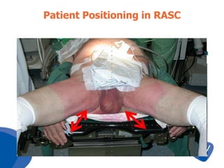 Patient Positioning in RASC

Steep Trendelenburg + Modified Lithotomy position

40

°

 