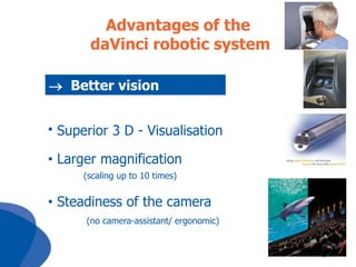 Advantages of the
daVinci robotic system
 Better vision
• Superior 3 D - Visualisation
• Larger magnification
(scaling up to 10 times)

• Steadiness of the camera
(no camera-assistant/ ergonomic)

 