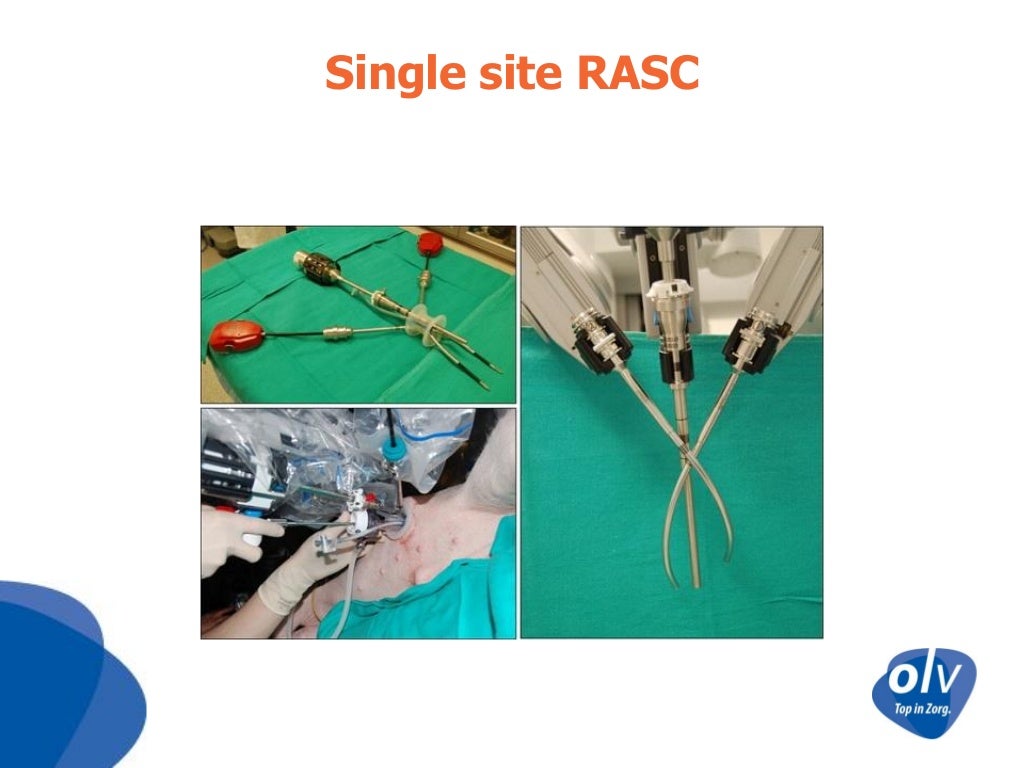 Robotic Sacrocolpopexy OLV