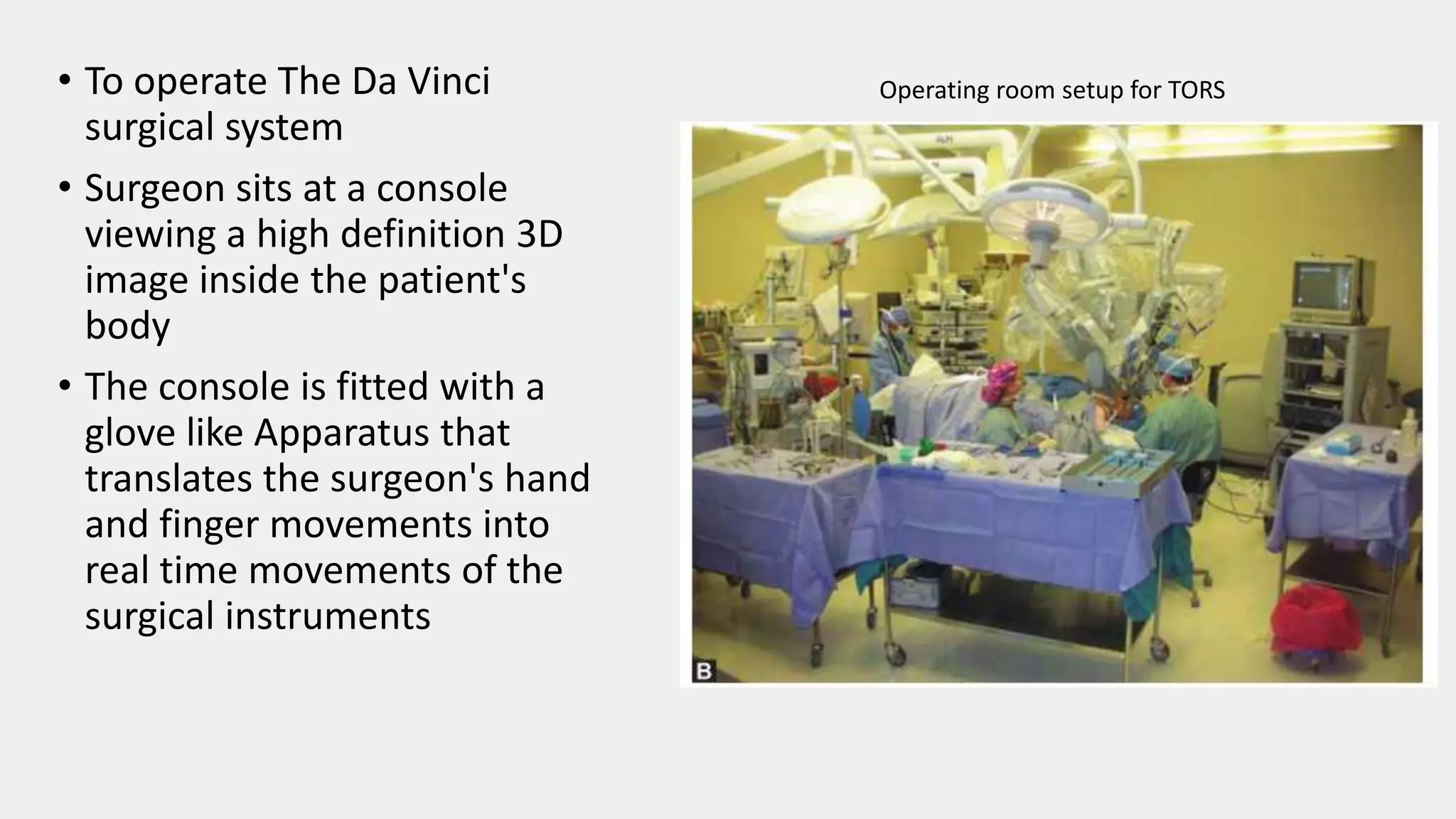 • To operate The Da Vinci
surgical system
• Surgeon sits at a console
viewing a high definition 3D
image inside the patient's
body
• The console is fitted with a
glove like Apparatus that
translates the surgeon's hand
and finger movements into
real time movements of the
surgical instruments
Operating room setup for TORS
 
