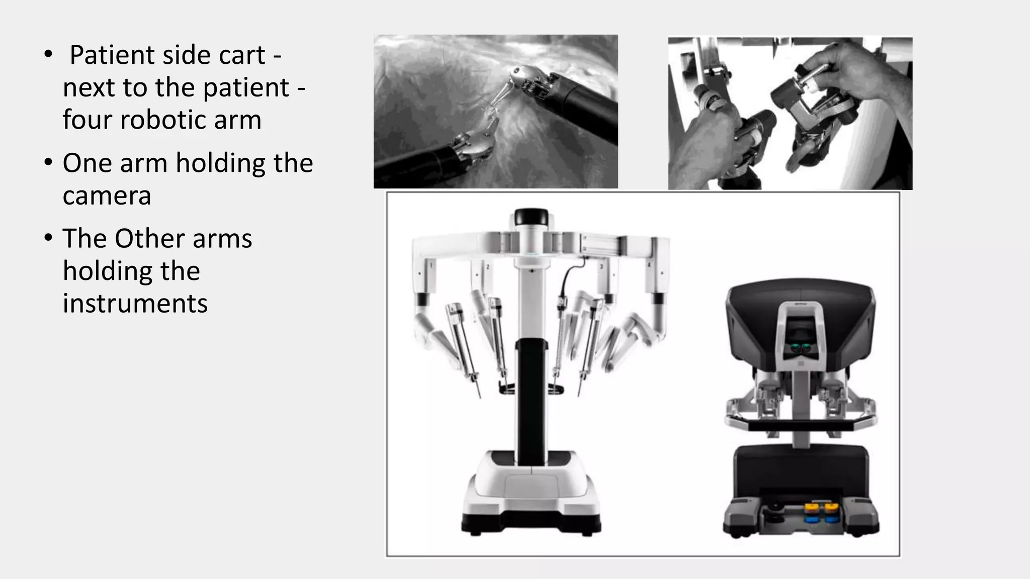 • Patient side cart -
next to the patient -
four robotic arm
• One arm holding the
camera
• The Other arms
holding the
instruments
 