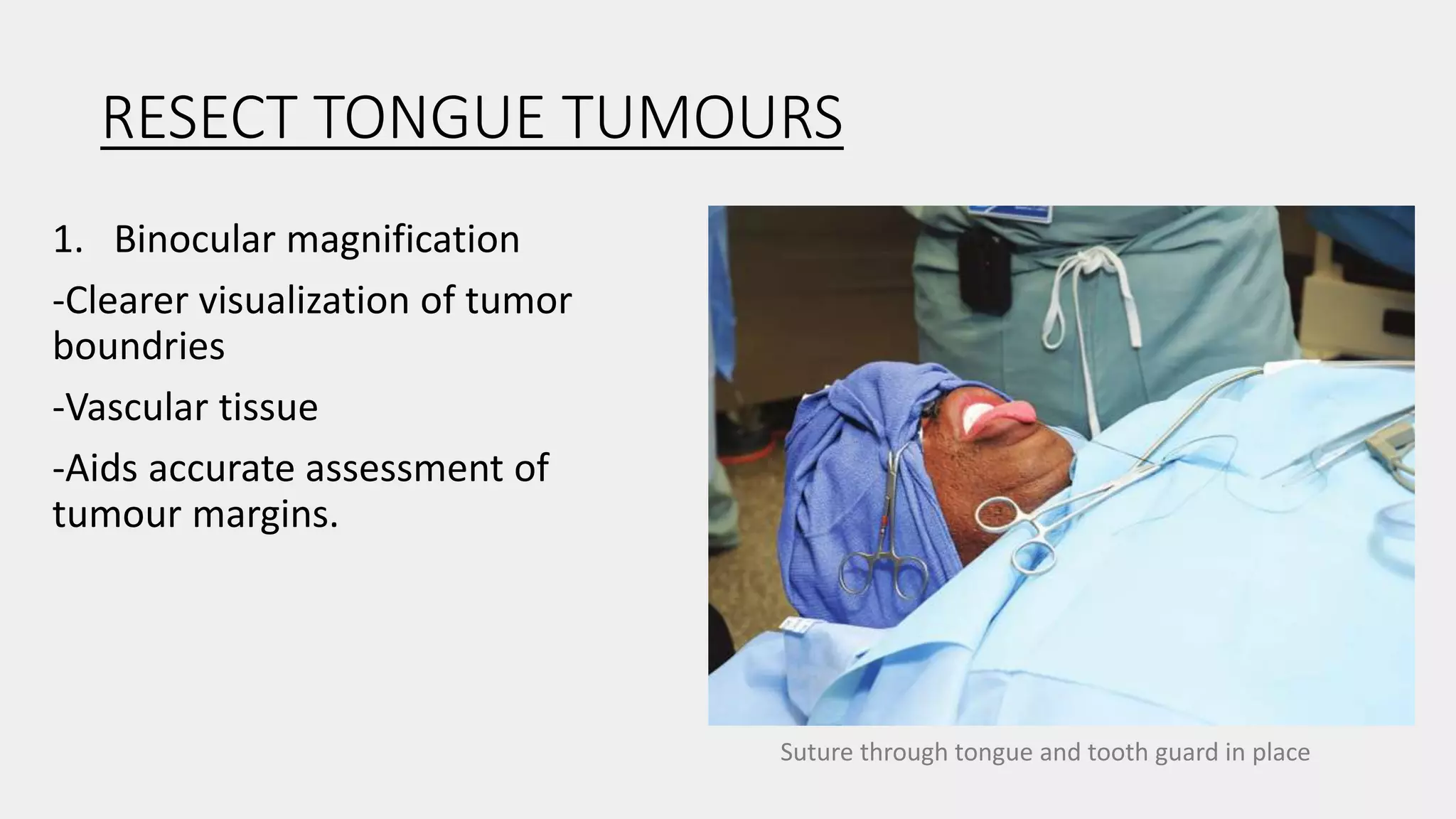 RESECT TONGUE TUMOURS
1. Binocular magnification
-Clearer visualization of tumor
boundries
-Vascular tissue
-Aids accurate assessment of
tumour margins.
Suture through tongue and tooth guard in place
 