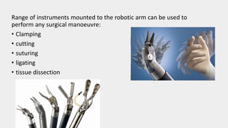 Range of instruments mounted to the robotic arm can be used to
perform any surgical manoeuvre:
• Clamping
• cutting
• suturing
• ligating
• tissue dissection
 