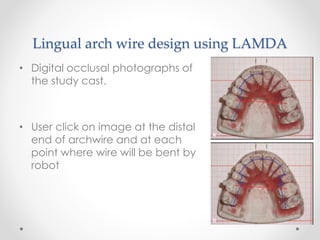 Lingual arch wire design using LAMDA
• Digital occlusal photographs of
the study cast.
• User click on image at the distal
end of archwire and at each
point where wire will be bent by
robot
 