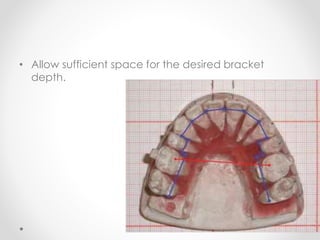 • Allow sufficient space for the desired bracket
depth.
 