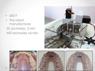 • 600 F
• The robot
manufactures
SS archwires 5 min
NiTi archwires =6 min
 