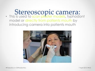 Stereoscopic camera:• This is used to scan plaster models, typhodont
model or directly from patients mouth by
introducing camera into patients mouth
Robotics in Orthodontics 457 April 2015
 