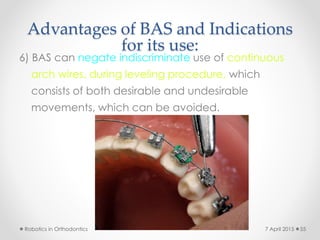 Advantages of BAS and Indications
for its use:
6) BAS can negate indiscriminate use of continuous
arch wires, during leveling procedure, which
consists of both desirable and undesirable
movements, which can be avoided.
Robotics in Orthodontics 557 April 2015
 