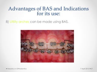 Advantages of BAS and Indications
for its use:
8) Utility arches can be made using BAS.
Robotics in Orthodontics 577 April 2015
 