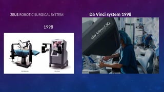ZEUS ROBOTIC SURGICAL SYSTEM
1998
Da Vinci system 1998
 